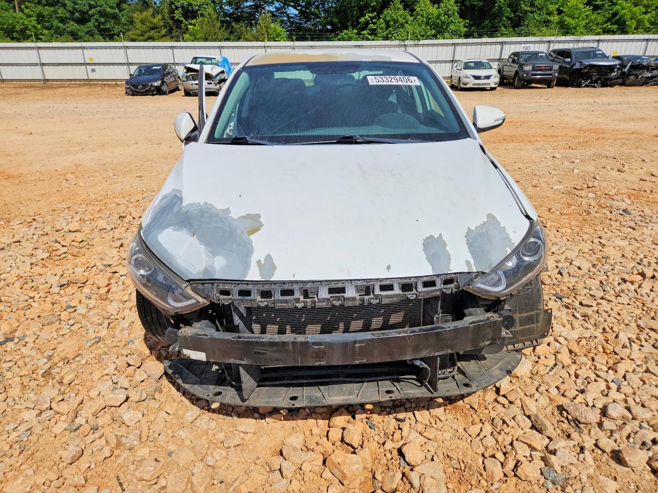 2017 HYUNDAI ELANTRA