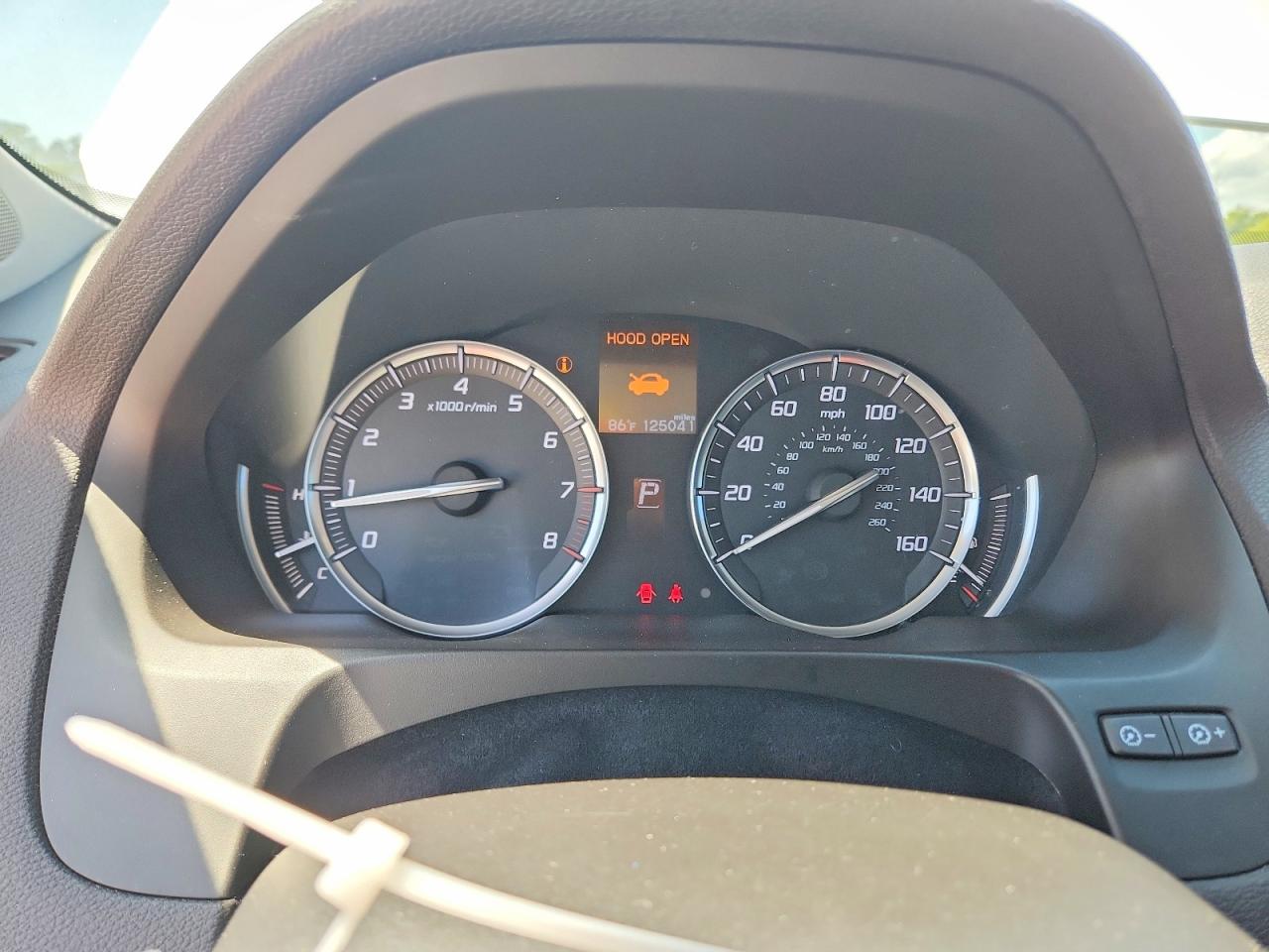 2015 ACURA TLX