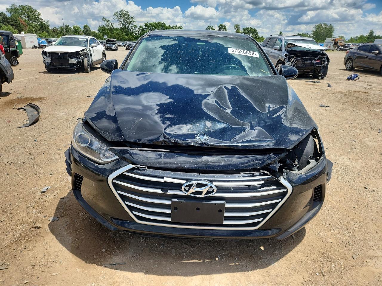 2017 HYUNDAI ELANTRA