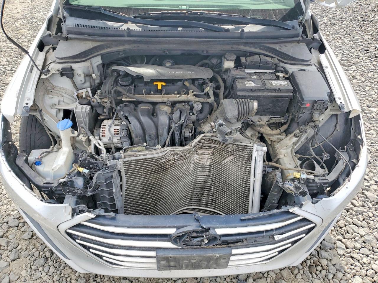 2017 HYUNDAI ELANTRA