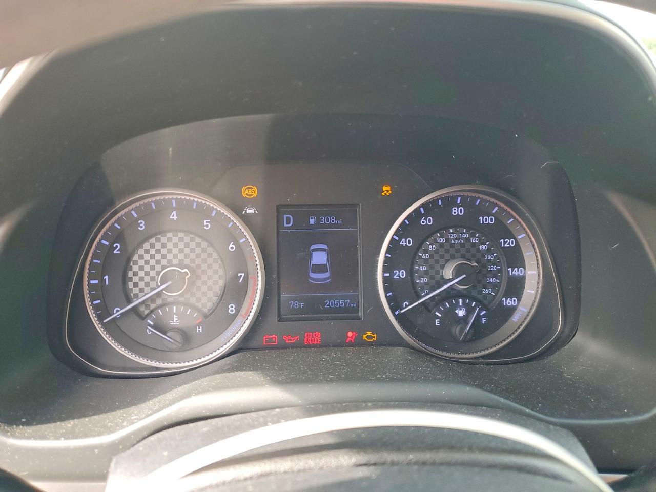 2020 HYUNDAI ELANTRA