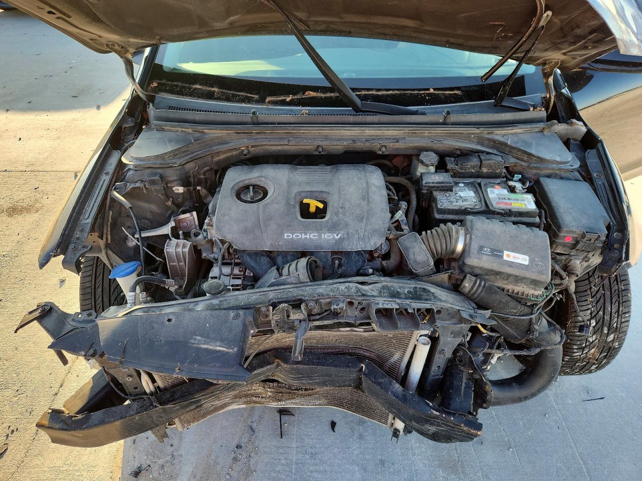 2018 HYUNDAI ELANTRA