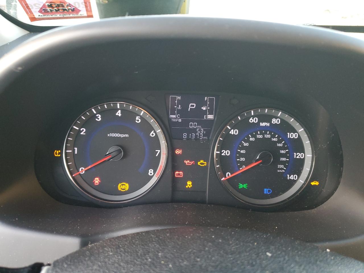 2017 HYUNDAI ACCENT